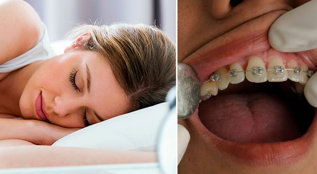 ¿Qué Significa Soñar Que Se Te Caen Los Brackets?